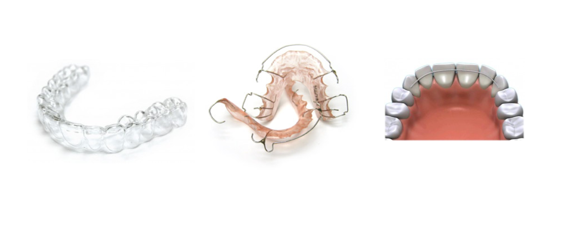 examples of orthodontic treatments