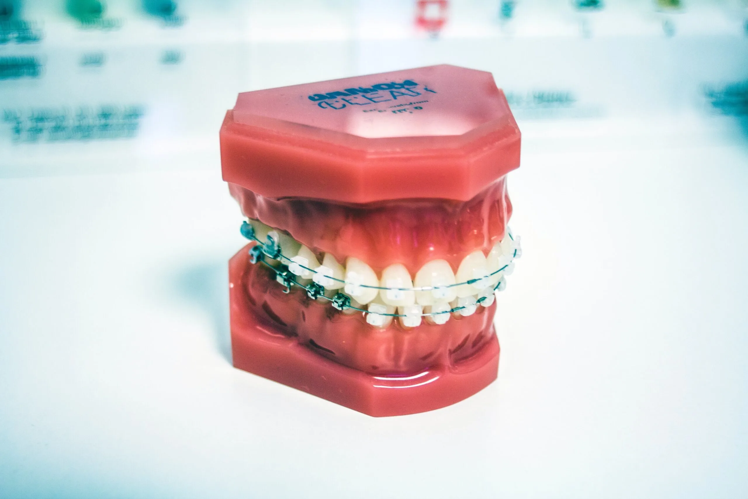 What is root resorption, image of braces on model of teeth