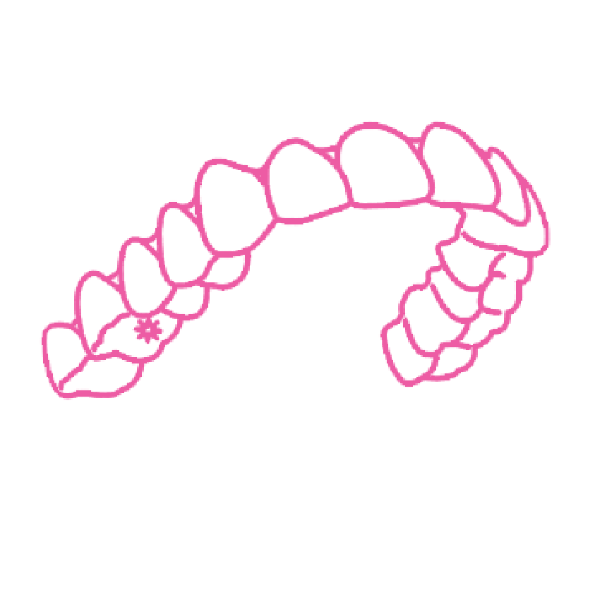 Pink Invisalign Logo