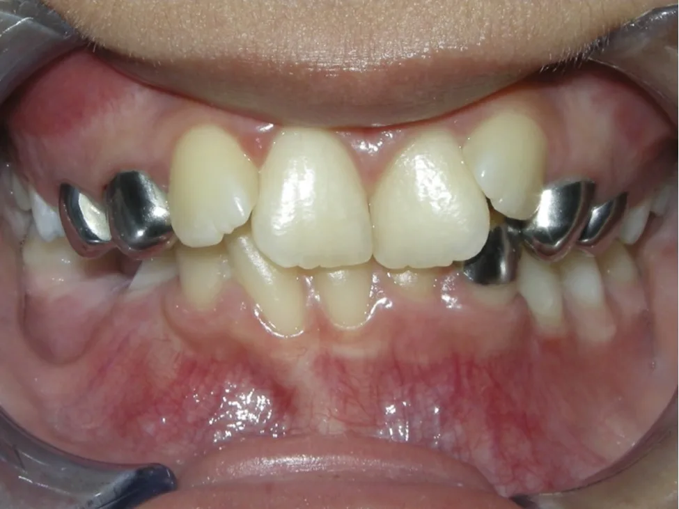321 Patient Before/After