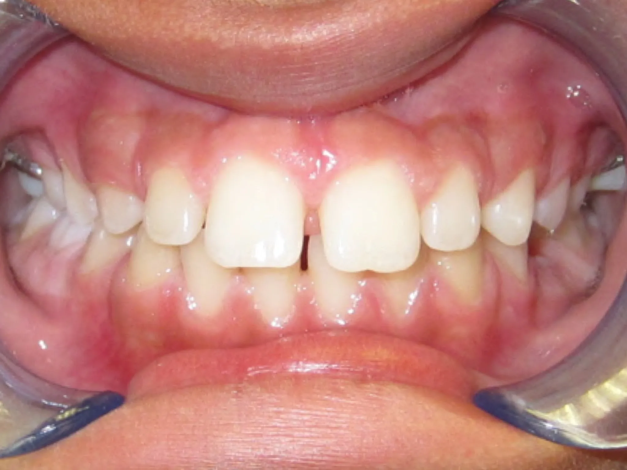 321 Patient Before/After