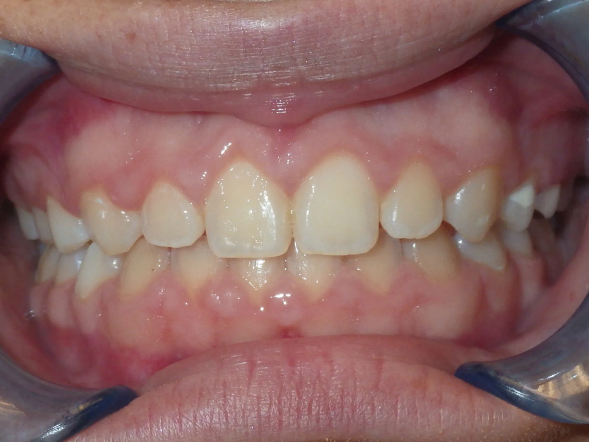 321 Patient Before/After