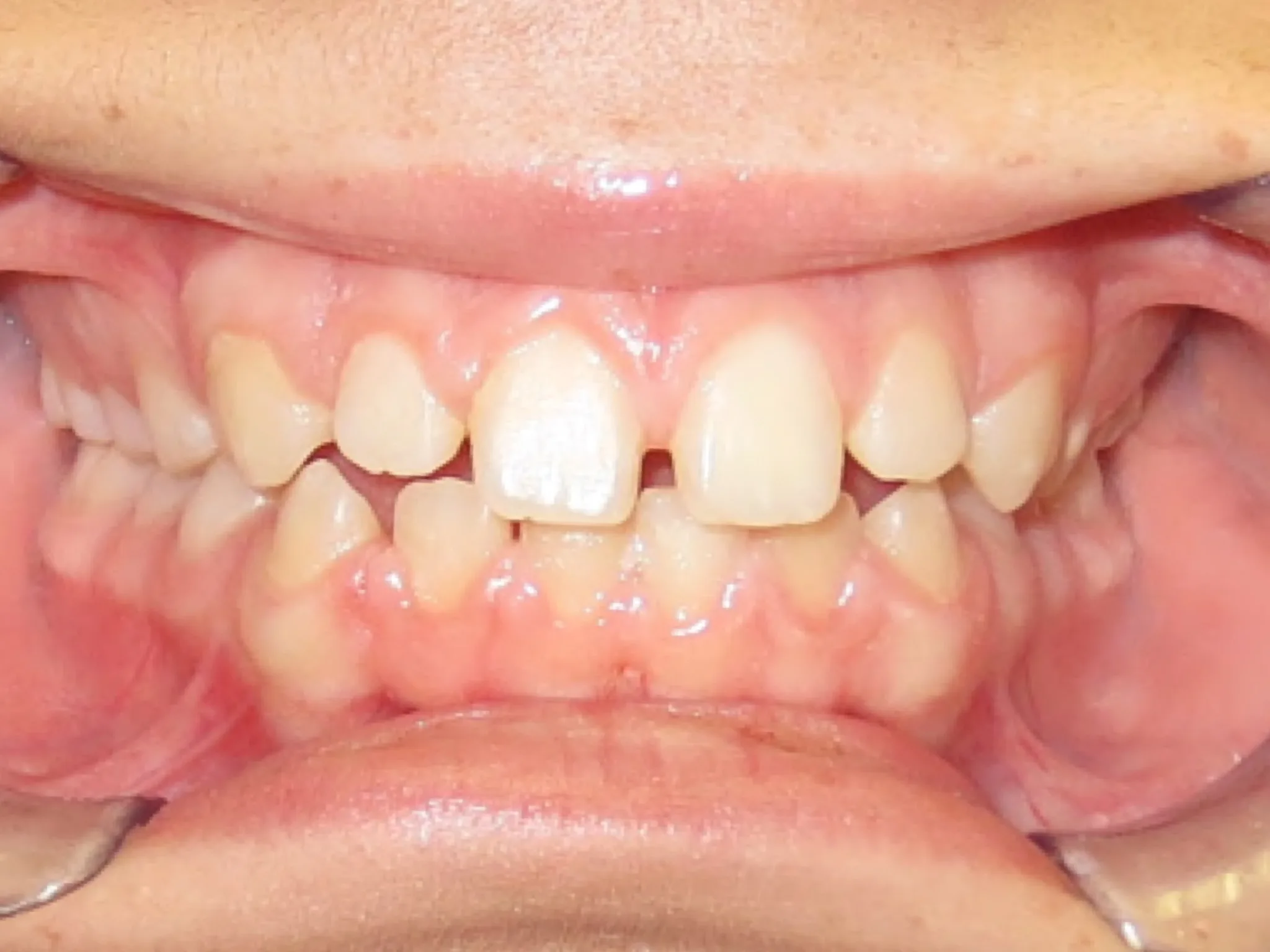 321 Patient Before/After