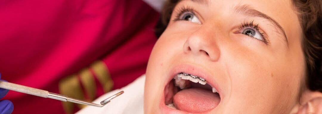 Back to school braces